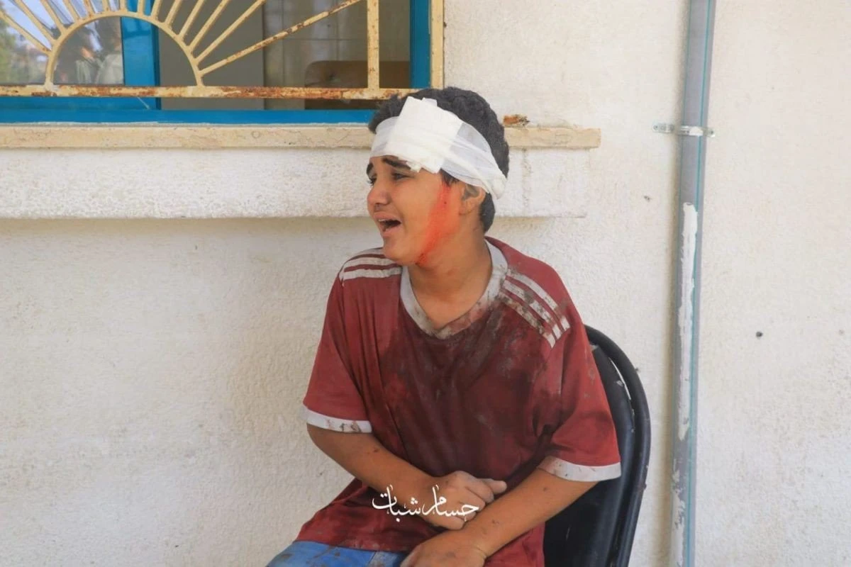 Τραυματισμένο παιδί στη Γάζα. Πηγή: https://www.facebook.com/photo/?fbid=1556160901793286&set=pcb.1556161261793250