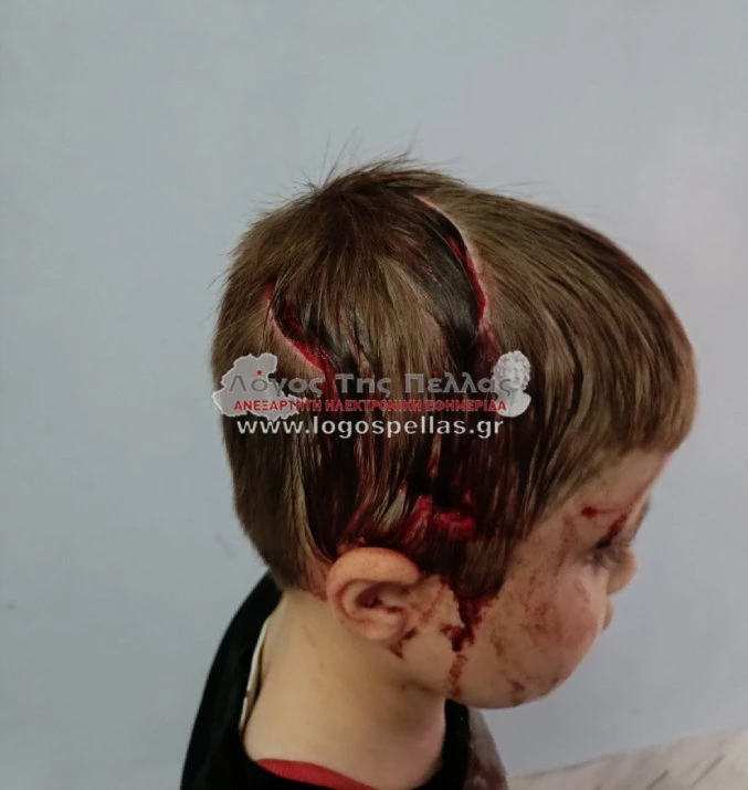 mikroyli.jpg mikroyli.jpg