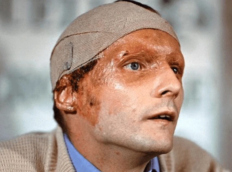 ﻿ Ο Νίκι Λάουντα μετά το ατύχημα