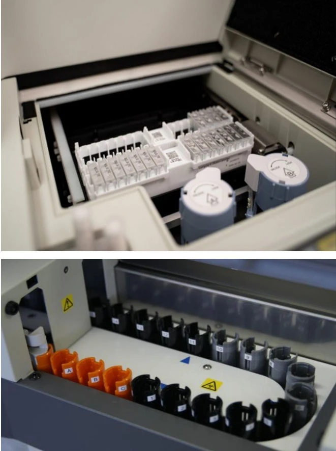 Ο επιτραπέζιος ανοσολογικός αναλυτής Lumipulse G600II