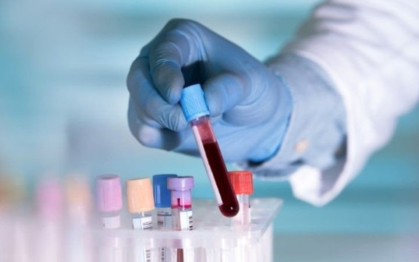 Σε ισχύ η ηλεκτρονική συνταγογράφηση για γενετικές εξετάσεις κληρονομούμενου καρκίνου - Ποια η διαδικασία