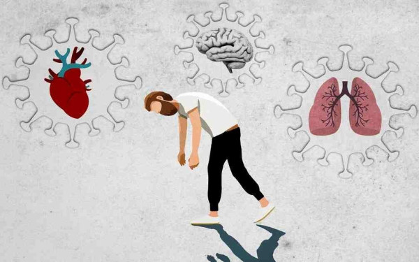 Κορονοϊός: Μικρότερος ο κίνδυνος μακρόχρονης Covid-19 επί Όμικρον από ό,τι επί Δέλτα