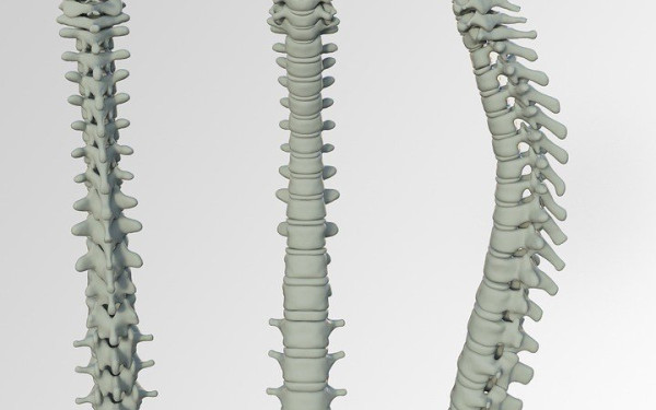 Βιοτεχνολογικά εμφυτεύματα σπονδυλικής στήλης θεραπεύουν την παράλυση