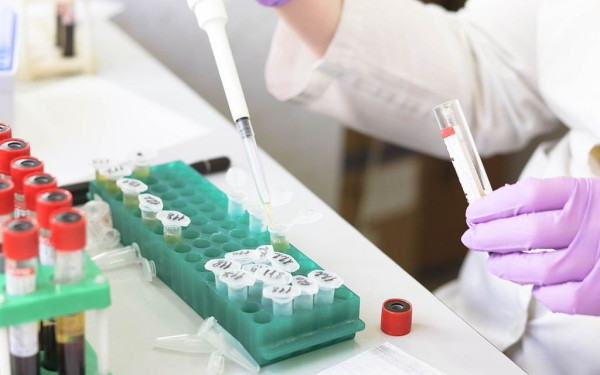 Τα αντιβιοτικά χάνουν επικίνδυνα την αποτελεσματικότητά τους - Τι λύσεις ψάχνει η επιστήμη