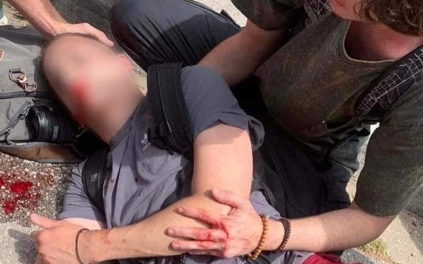 ΑΠΘ: Νέες συγκρούσεις φοιτητών και αστυνομίας - Φοιτητής τραυματίστηκε στο κεφάλι και έχασε την ακοή από το ένα του αυτί