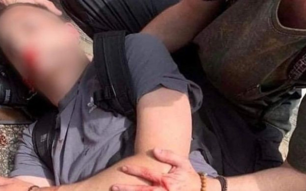 Ξανά στο νοσοκομείο ο φοιτητής που τραυματίστηκε στα επεισόδια του ΑΠΘ