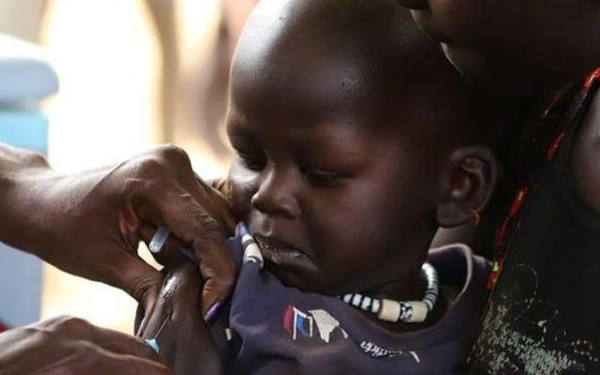 Τραγωδία με 157 νεκρά παιδιά από ιλαρά στη Ζιμπάμπουε