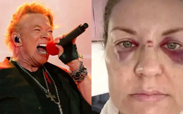 Guns n' Roses: Ο Axl Rose πέταξε το μικρόφωνό του και τραυμάτισε σοβαρά μια γυναίκα (βίντεο)