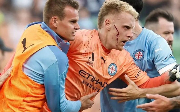 Σκηνές χάους στην Αυστραλία: Τερματοφύλακας πέταξε πυρσό σε οπαδούς κι αυτοί του άνοιξαν το κεφάλι (βίντεο)