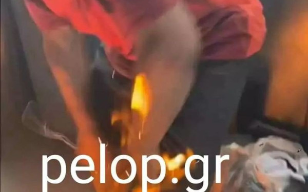 Φρίκη στην Πάτρα: Τον ανάγκασαν να πει τα κάλαντα γονατιστός και του έβαλαν φωτιά (φωτ.)