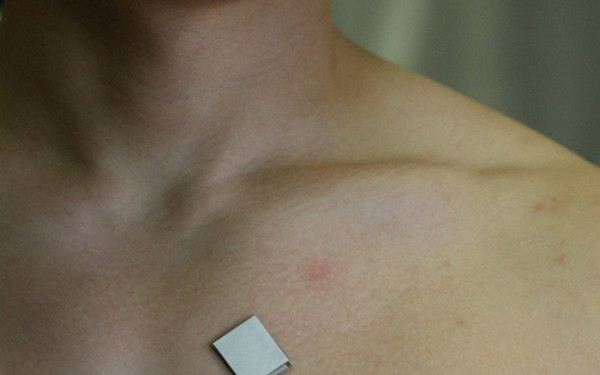 Τρίπλεξ καρδιάς εν κινήσει: Δημιουργήθηκε στις ΗΠΑ ο πρώτος φορετός αισθητήρας υπερήχων για την καρδιά