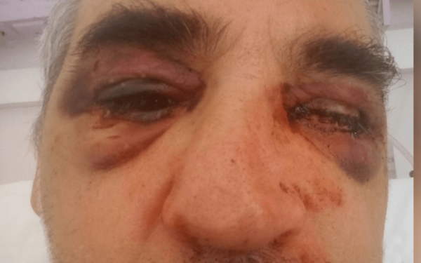 Εργολαβικά συμφέροντα πίσω από τον ξυλοδαρμό αρχαιολόγου στη Μύκονο αποκαλύπτει η Daily Telegraph