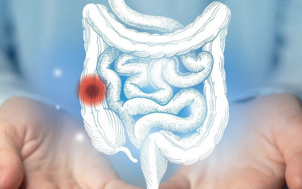 Η Τεχνητή Νοημοσύνη βοηθάει στον εντοπισμό προκαρκινικών βλαβών στον γαστρεντερικό σωλήνα