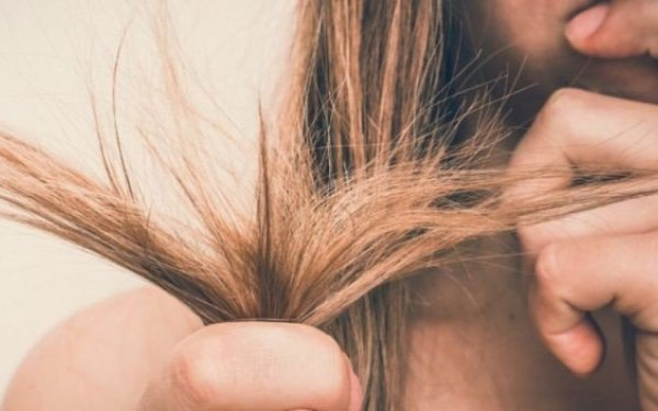 Γιατρός 14χρονης με Σύνδρομο Ραπουνζέλ: «Το στομάχι της είχε διαταθεί τόσο πολύ που τρύπησε - Ήταν διπλά επικίνδυνο» (βίντεο)