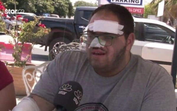 Παρέμβαση του ΣΕΠΕ για τον ανασφάλιστο εγκαυματία μάγειρα στην Κρήτη - «Καμία ανοχή», λέει ο Γεωργιάδης (βίντεο)