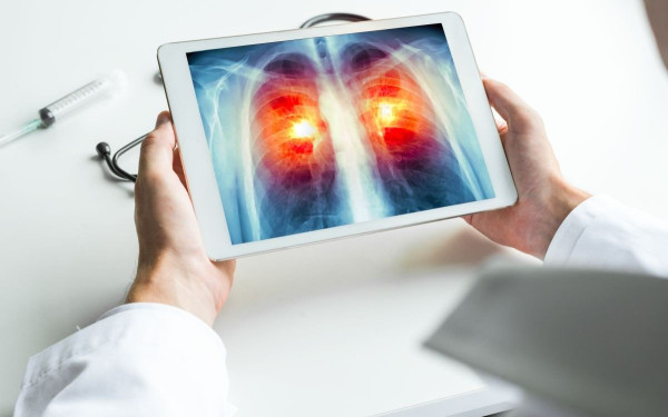 Σύσταση σε όσους καπνίζουν: Κάντε ετήσιο έλεγχο για καρκίνο του πνεύμονα