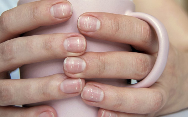 Σπάνια διαταραχή στα νύχια, λόγω Covid φέρνει στο φως ελληνική μελέτη - Τι είναι οι γραμμές του Beau