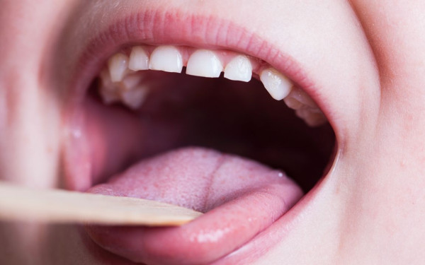 «Καμπανάκι» από Παγώνη για τον στρεπτόκοκκο: «Γίνεται πανικός, είναι πολλά τα κρούσματα» (βίντεο)