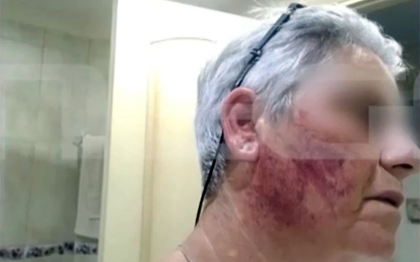 Χαλκίδα: Νοσηλευτής κατηγορείται για τον άγριο ξυλοδαρμό της συζύγου του - «Φώναζα “άφησε με, βοήθεια”» (βίντεο)