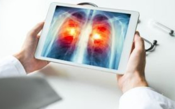 Θεσσαλονίκη: Δεν είναι «αθώα» τα νέα καπνικά προϊόντα, λέει καθηγήτρια πνευμονολογίας του ΑΠΘ Θεσσαλονίκη: Δεν είναι «αθώα» τα νέα καπνικά προϊόντα, λέει καθηγήτρια πνευμονολογίας του ΑΠΘ