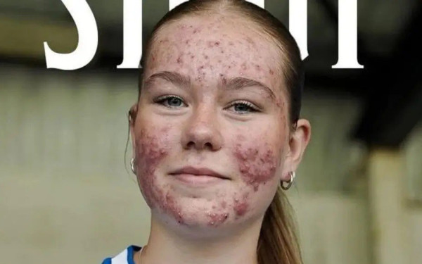 Σκωτία: Η Στουτ σκόραρε στο ντεμπούτο της και έδωσε την καλύτερη απάντηση στον σεξισμό (βίντεο)