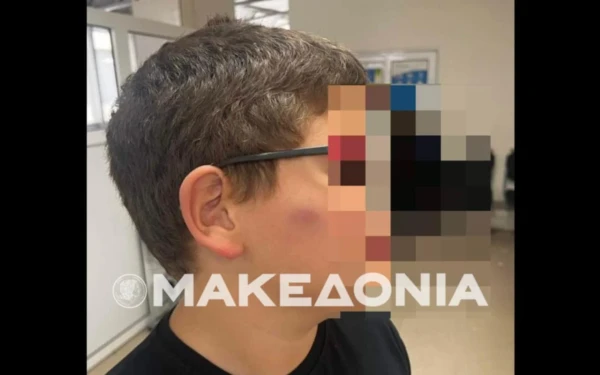 Θεσσαλονίκη: ΕΔΕ για τον ξυλοδαρμό μαθητή από άλλους μαθητές σε δημοτικό σχολείο στο Παλαιόκαστρο Θεσσαλονίκη: ΕΔΕ για τον ξυλοδαρμό μαθητή από άλλους μαθητές σε δημοτικό σχολείο στο Παλαιόκαστρο