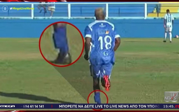 Σάλος στη Βραζιλία: Ποδοσφαιριστής αγωνίζεται φορώντας «βραχιολάκι» στο πόδι (βίντεο)