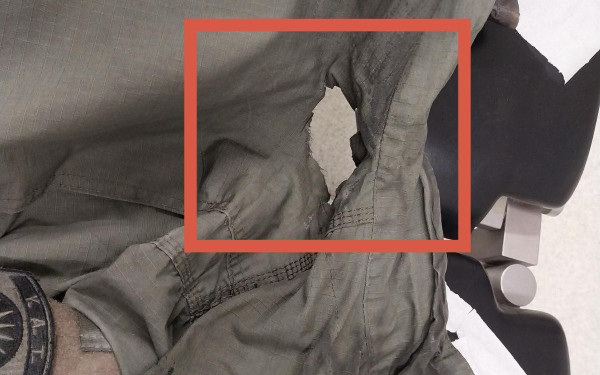 Σύγχρονα μέσα ζητούν οι αστυνομικοί της Θεσσαλονίκης - Η μολότοφ άνοιξε τρύπα στη στολή του αστυνομικού στα επεισόδια του ΑΠΘ