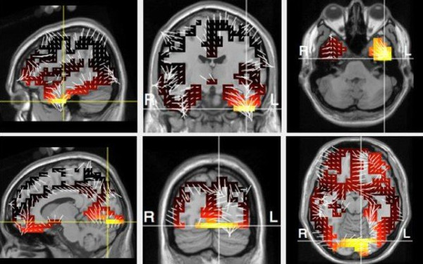 Θεσσαλονίκη - 2D-BioPAD: Έρευνα για δημιoυργία ψηφιακού εργαλείου έγκαιρη διάγνωσης Alzheimer Θεσσαλονίκη - 2D-BioPAD: Έρευνα για δημιoυργία ψηφιακού εργαλείου έγκαιρη διάγνωσης Alzheimer