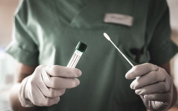 Αντιδρά ο Ιατρικός Σύλλογος Θεσσαλονίκης για τα πλαφόν στα τεστ κορoνοϊού