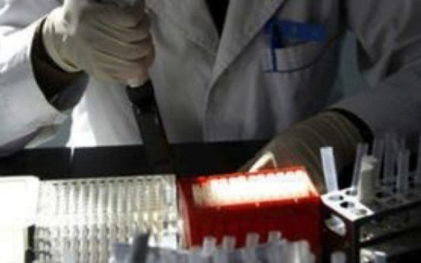 Ελληνική Μικροβιολογική Εταιρεία: Η απόφαση του ΕΟΠΥΥ για είσπραξη του clawback οδηγεί τα εργαστήρια στο κλείσιμο