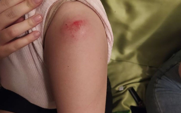 Πώς οδηγήθηκε η ΕΛ.ΑΣ. σε επέμβαση στην Άνω Πόλη