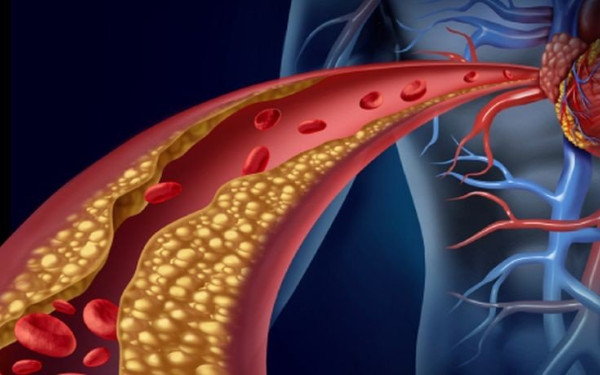 Θεσσαλονίκη: Δωρεάν έλεγχος χοληστερόλης και τριγλυκεριδίων στην πλ. Αριστοτέλους