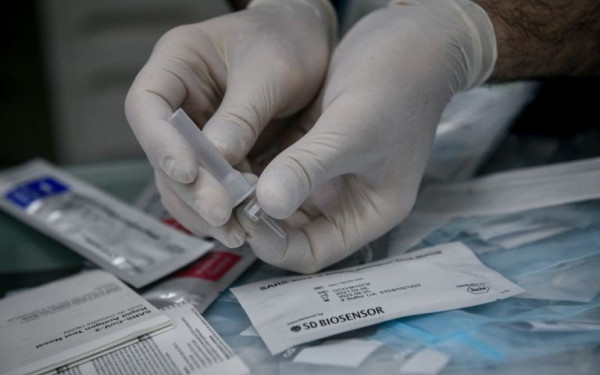 Παναγιωτακόπουλος για ψευδή self test: Ο ΕΟΔΥ θα διερευνήσει αν πρόκειται για λάθος παρτίδα