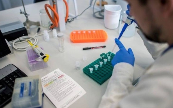  Ηλ. Μόσιαλος: Γιατί πρέπει να ελεγχθεί η διασπορά της πιο μεταδοτικής παραλλαγής Δέλτα του κορονοϊού