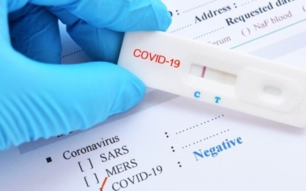 Θεσσαλονίκη: Ενδείξεις αποκλιμάκωσης του ιικού φορτίου κορονοϊού και γρίπης Α στα λύματα