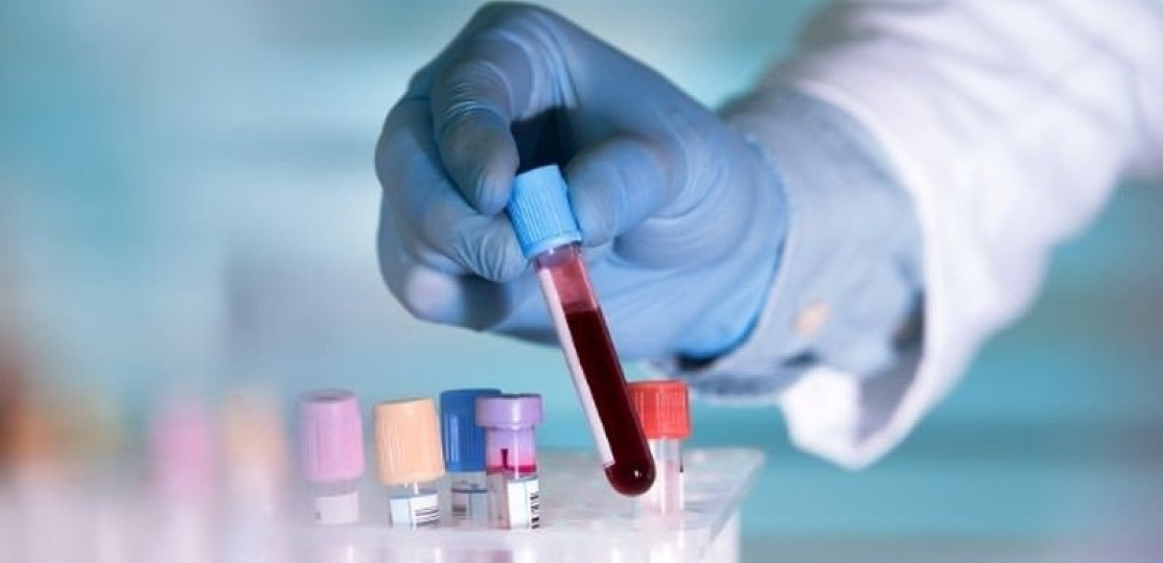 Θεσσαλονίκη: Εξελιγμένες τεχνικές ακτινοθεραπείες προσφέρουν ασφαλείς και αποτελεσματικές θεραπείες για τον καρκίνο του μαστού