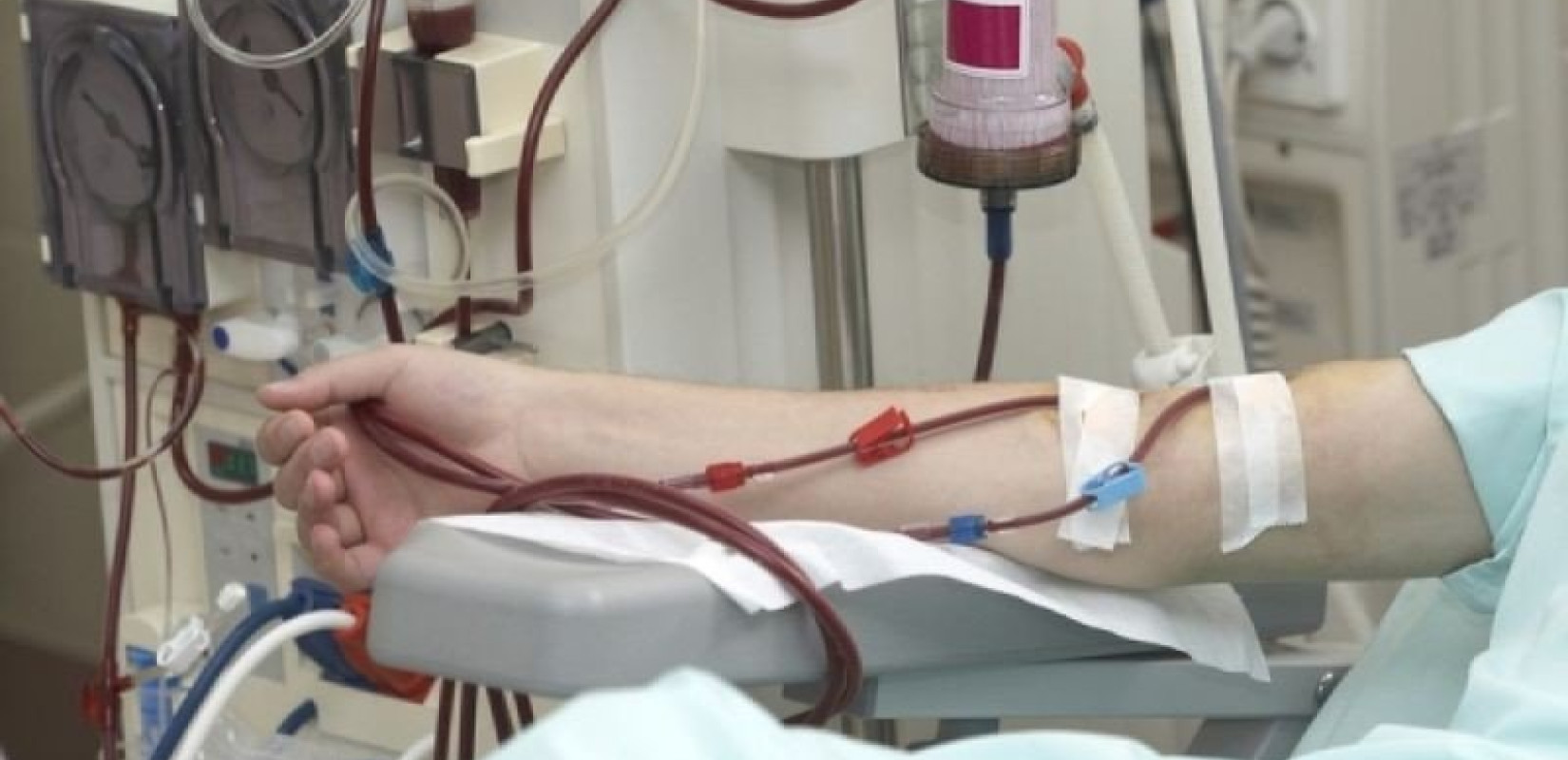 Πλατφόρμα εικονικής πραγματικότητας για την προώθηση υγιεινού τρόπου ζωής σε ασθενείς με χρόνια νεφρική νόσο  Πλατφόρμα εικονικής πραγματικότητας για την προώθηση υγιεινού τρόπου ζωής σε ασθενείς με χρόνια νεφρική νόσο