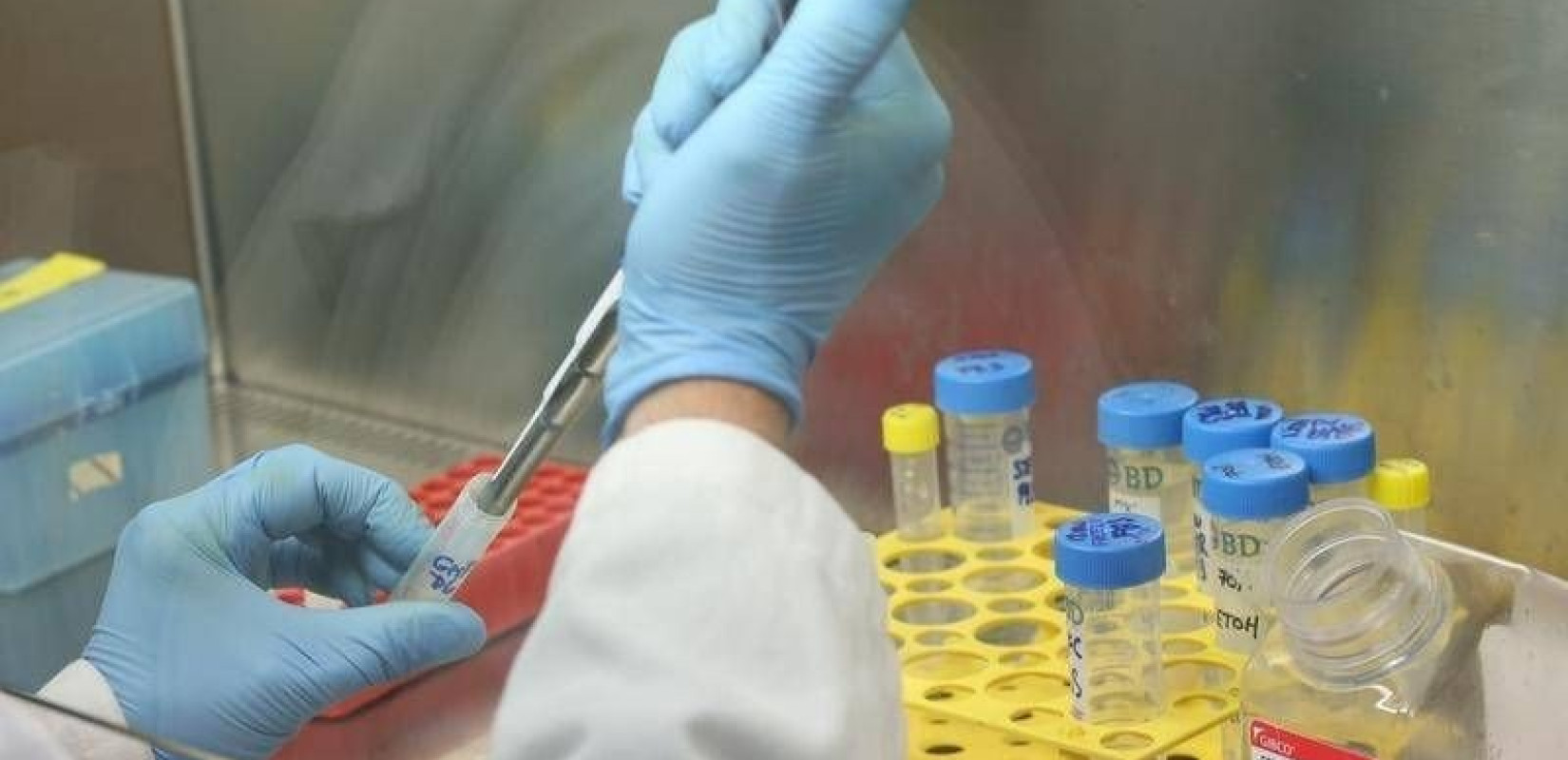 Νέα πειραματική θεραπεία με mRNA καταπολεμά λοιμώξεις ανθεκτικές στα αντιβιοτικά
