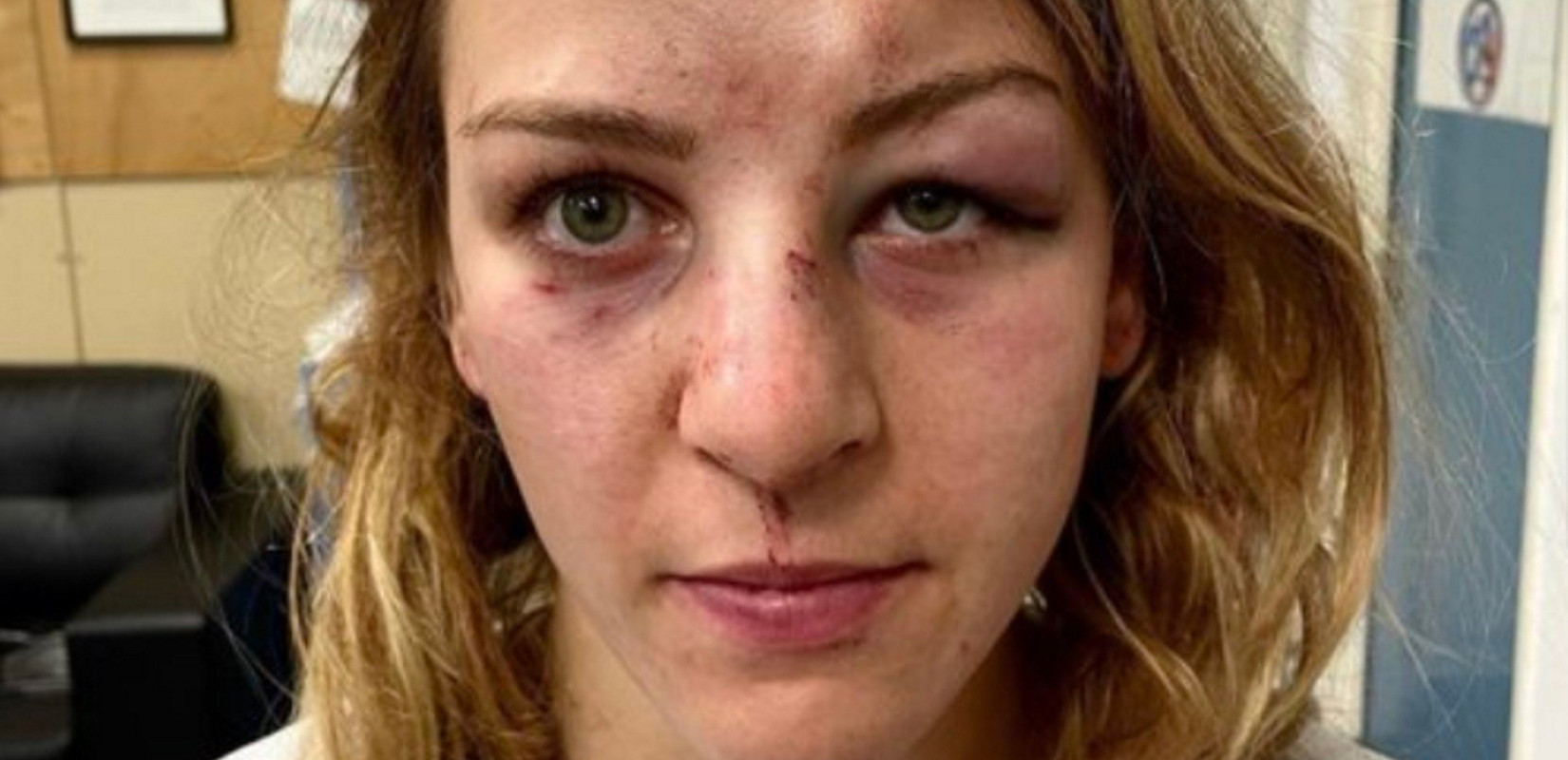 Γαλλία: Η Ολυμπιονίκης Μαργκό Πινό καταγγέλλει κακοποίηση από τον σύντροφο και προπονητή της