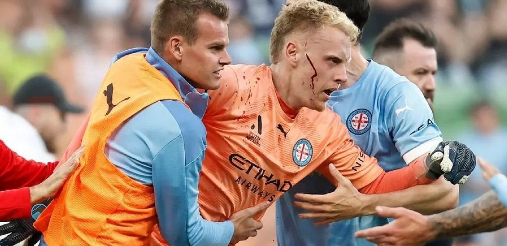 Σκηνές χάους στην Αυστραλία: Τερματοφύλακας πέταξε πυρσό σε οπαδούς κι αυτοί του άνοιξαν το κεφάλι (βίντεο)