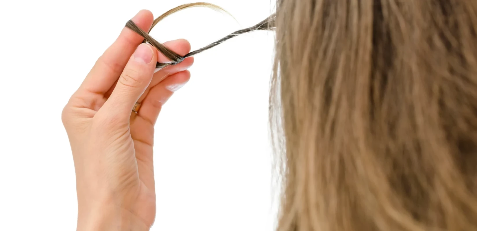 Σύνδρομο Ραπουνζέλ: Μία διαταραχή διόλου παραμυθένια - Τι είναι και πώς απειλεί την υγεία Σύνδρομο Ραπουνζέλ: Μία διαταραχή διόλου παραμυθένια - Τι είναι και πώς απειλεί την υγεία