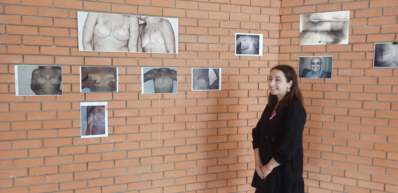 Θεσσαλονίκη: Η «ομορφιά του τραύματος» - Όταν ο καρκίνος του μαστού μετατρέπεται σε τέχνη δίνοντας μήνυμα ελπίδας Θεσσαλονίκη: Η «ομορφιά του τραύματος» - Όταν ο καρκίνος του μαστού μετατρέπεται σε τέχνη δίνοντας μήνυμα ελπίδας