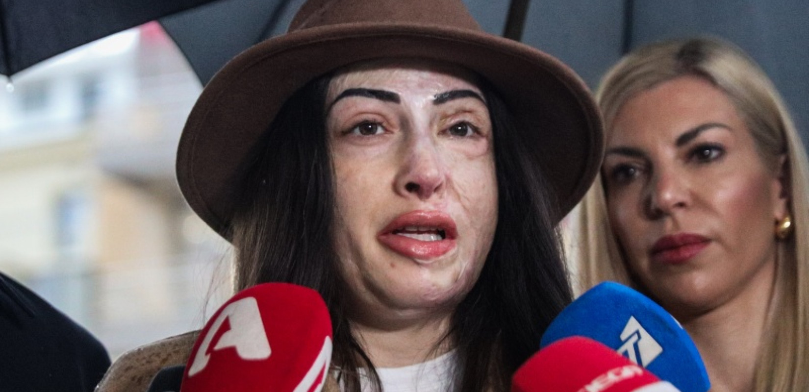 Παλιοσπύρου: Εννοείται ότι μπορεί να πεθάνει ένας άνθρωπος από βιτριόλι