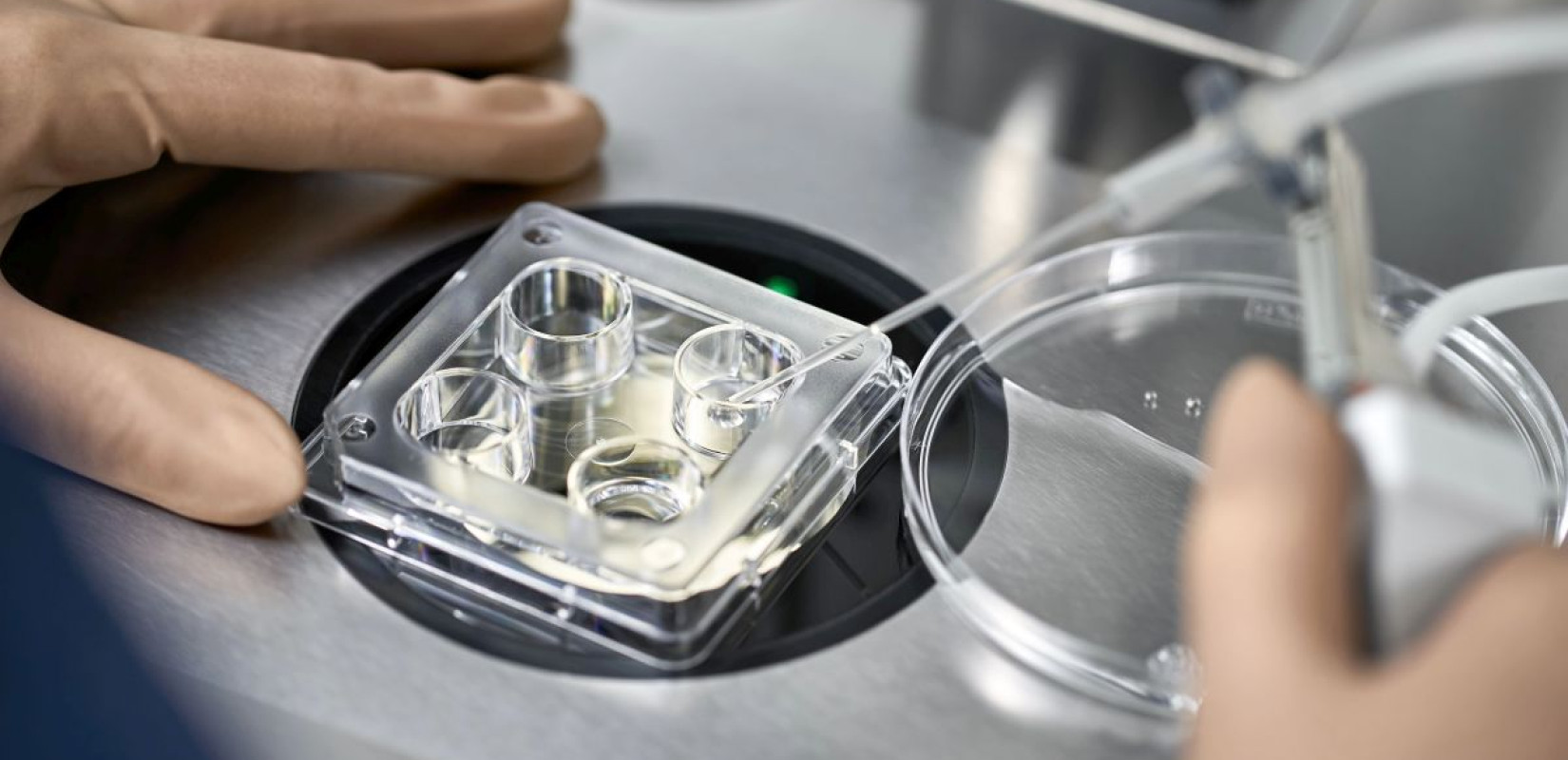 Ιός Νίπα: Ο ΠΟΥ αποκλείει μεγάλη διάδοση εκτός Ινδίας - Τι πρέπει να ξέρετε