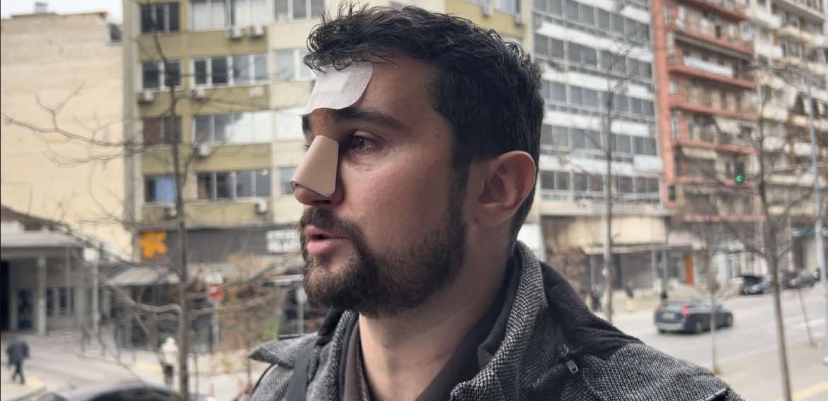 Θεσσαλονίκη: Καταδικάστηκε ο οδηγός ΙΧ, αθώος ο ταξιτζής που πιάστηκαν στα χέρια στη μέση του δρόμου (βίντεο) Θεσσαλονίκη: Καταδικάστηκε ο οδηγός ΙΧ, αθώος ο ταξιτζής που πιάστηκαν στα χέρια στη μέση του δρόμου (βίντεο)