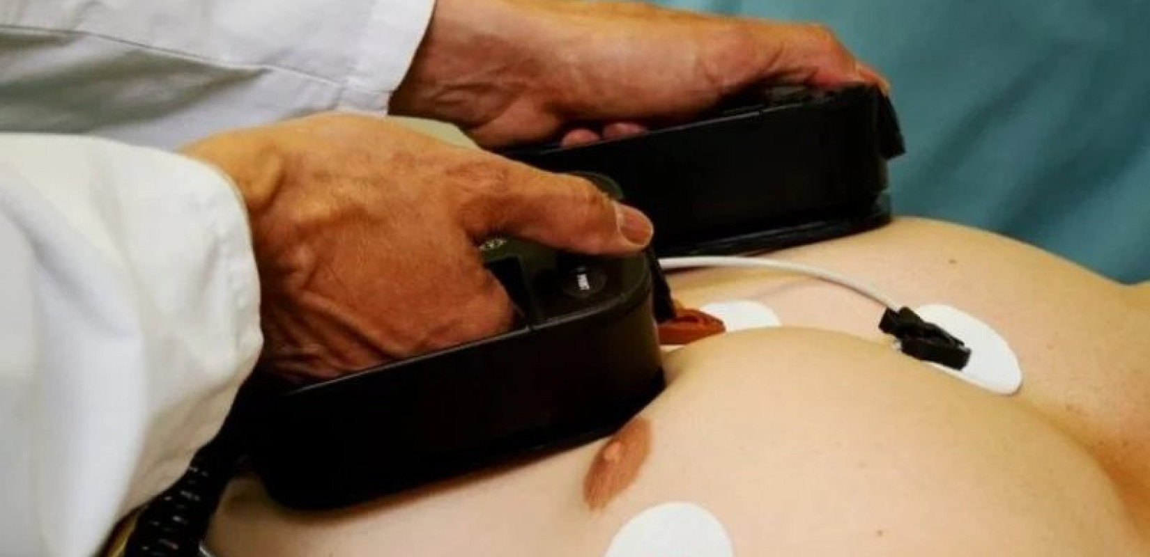 Θεσσαλονίκη: Τούρκοι καρδιολόγοι έσωσαν ταξιδιώτη που υπέστη ανακοπή στο αεροδρόμιο Μακεδονία Θεσσαλονίκη: Τούρκοι καρδιολόγοι έσωσαν ταξιδιώτη που υπέστη ανακοπή στο αεροδρόμιο Μακεδονία