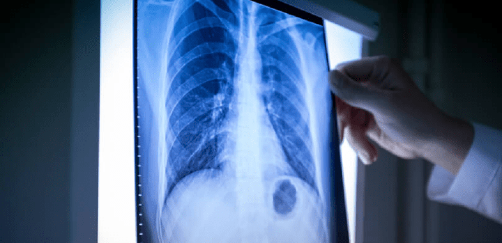 Πρόεδρος Ελληνικής Ακτινολογικής Εταιρείας: Να θεσπιστεί θεσμικό πλαίσιο για την τηλεακτινολογία στην Ελλάδα