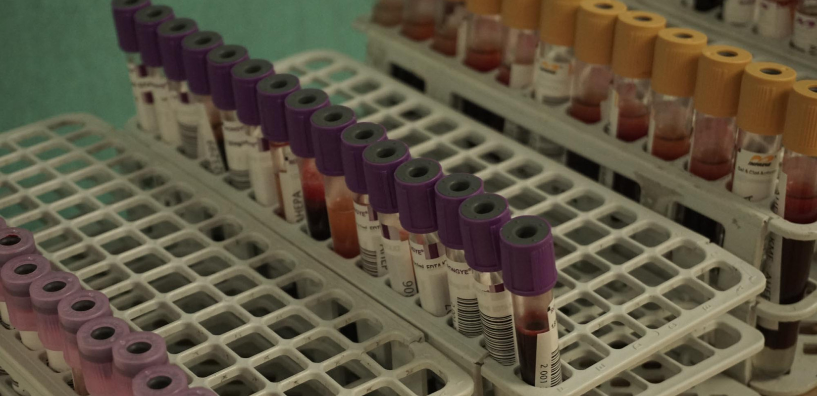 Εθελοντική Αιμοδοσία δήμου Νεάπολης-Συκεών: Με 132 επιπλέον μονάδες ενισχύθηκε η Τράπεζα Αίματος