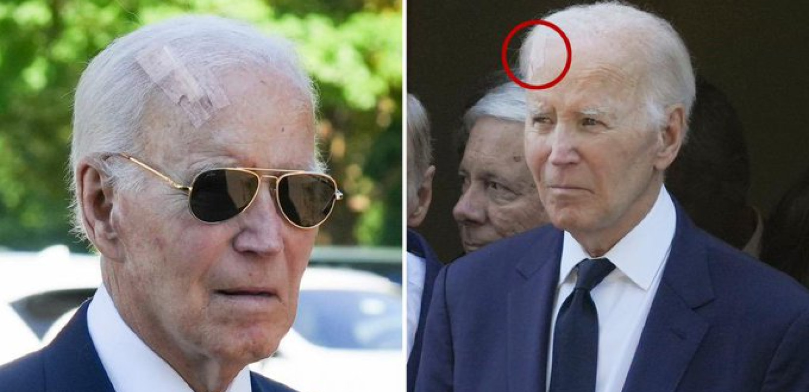 Τζο Μπάιντεν: Yποβλήθηκε σε χειρουργείο για καρκίνο του δέρματος